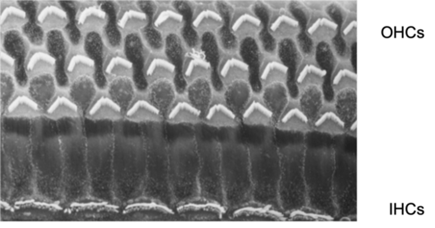 <p>What happens if there is a problem with your stereo cilia or they're damaged?</p>