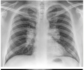 <p>what is this? and what causes it</p>