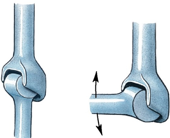 <p>Which type of synovial joint has:</p><ul><li><p>Angular motion in a single plane (monaxial)</p></li></ul><p></p>