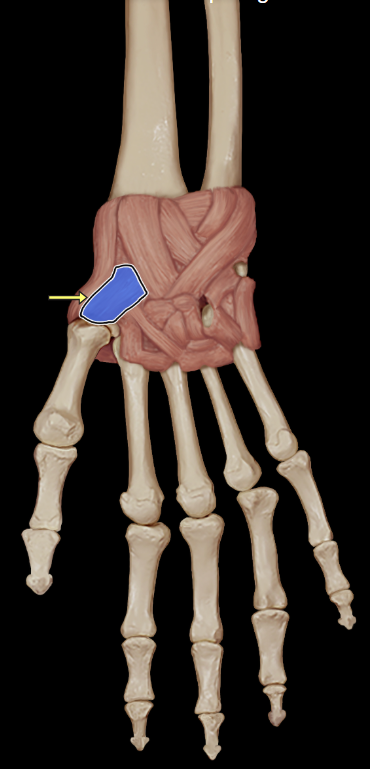 <p>Palmar intercarpal ligament</p>