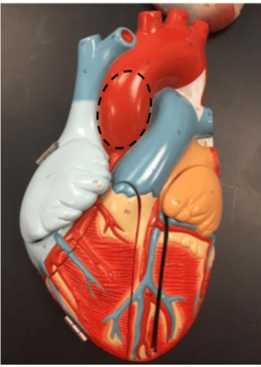 <p>is slightly posterior and is to the right of the pulmonary trunk</p>
