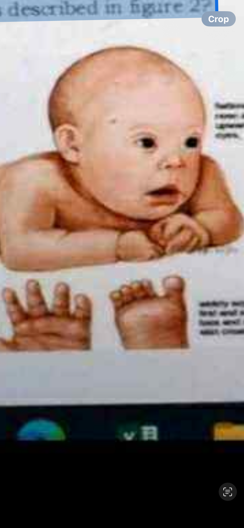 <p><span>Considering the characteristics</span></p><p><span>and appearance</span></p><p><span>chromosomal mutation is described in figure 2?</span></p>