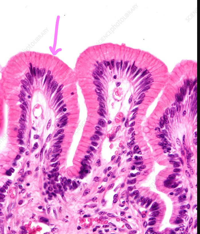 stomach