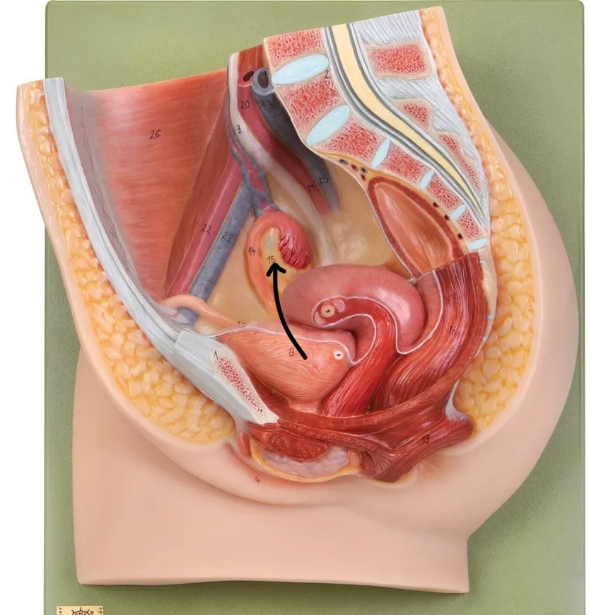 term image