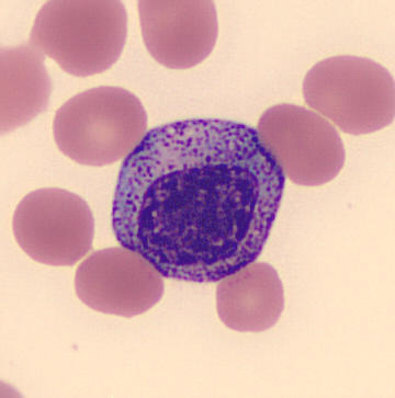 <ul><li><p>size: 10-18 um</p></li><li><p>N:C ratio is 2:1, nucleus is red-purple, oval, indented, and dense</p></li><li><p>cytoplasm: fine, red-blue granules</p></li><li><p>CD45, CD33, CD13, CD15, CD11</p></li></ul><p></p>