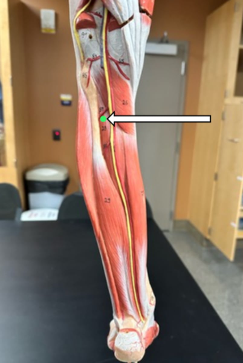 <p>tibialis posterior (function)</p>