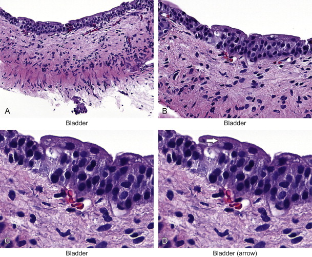 <p>transitional epithelium</p>