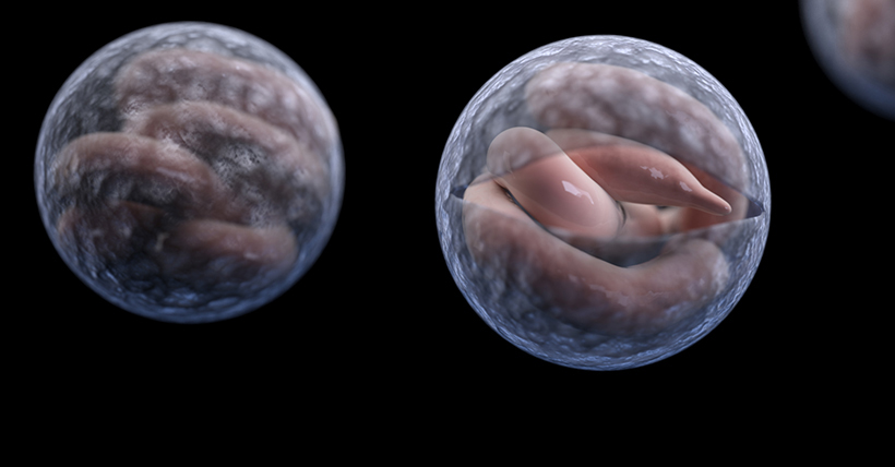 <p>Protozoan disease. </p><p>Caused by C. hominis and C. paravum. </p><p>Contaminated drinking water -&gt; watery diarrhea that lasts 1-2 weeks (self limiting). </p><p>Fecal oral route of transmission.</p>