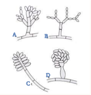<p>(chromoblastomycosis) fonsecaea pedrosi</p>