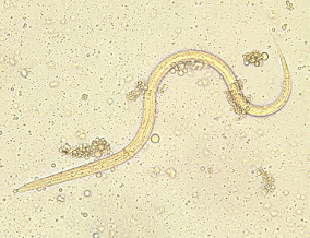 <p><span>What is the genus, species, and stage of this parasite?</span></p><p>• filariform larvae (L3) are up to 600 μm long</p><p>• The tail is notched</p><p>• esophagus to intestine ratio is 1:1</p>