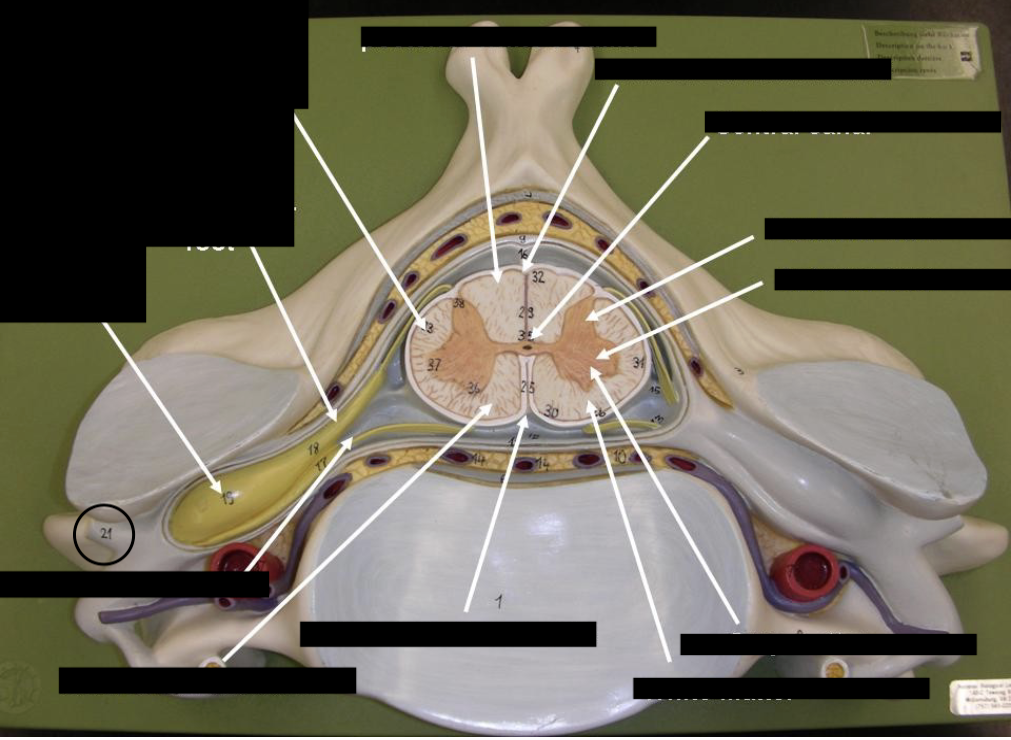 <p>what is this part of the vertebrae (of the spinal cord?)</p>
