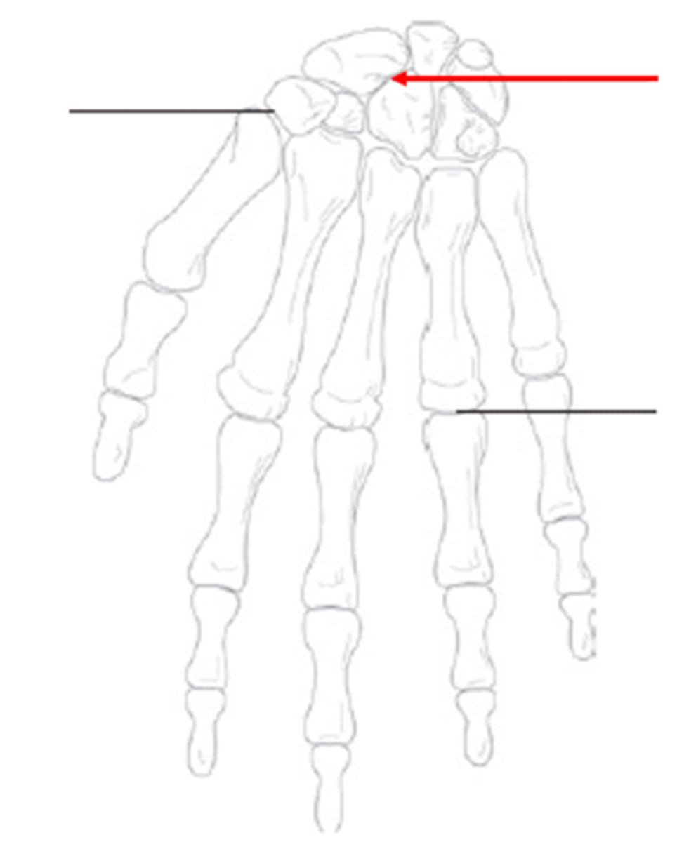 <p>What is the structural classification of this joint?</p>