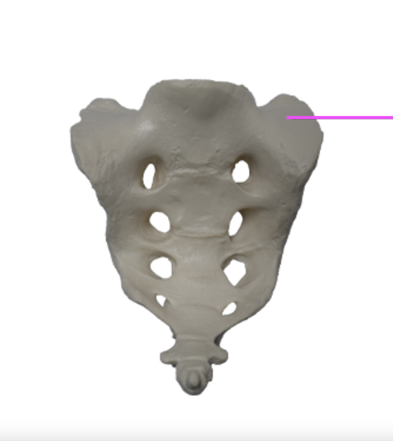<p>What part of the sacrum is this?</p>