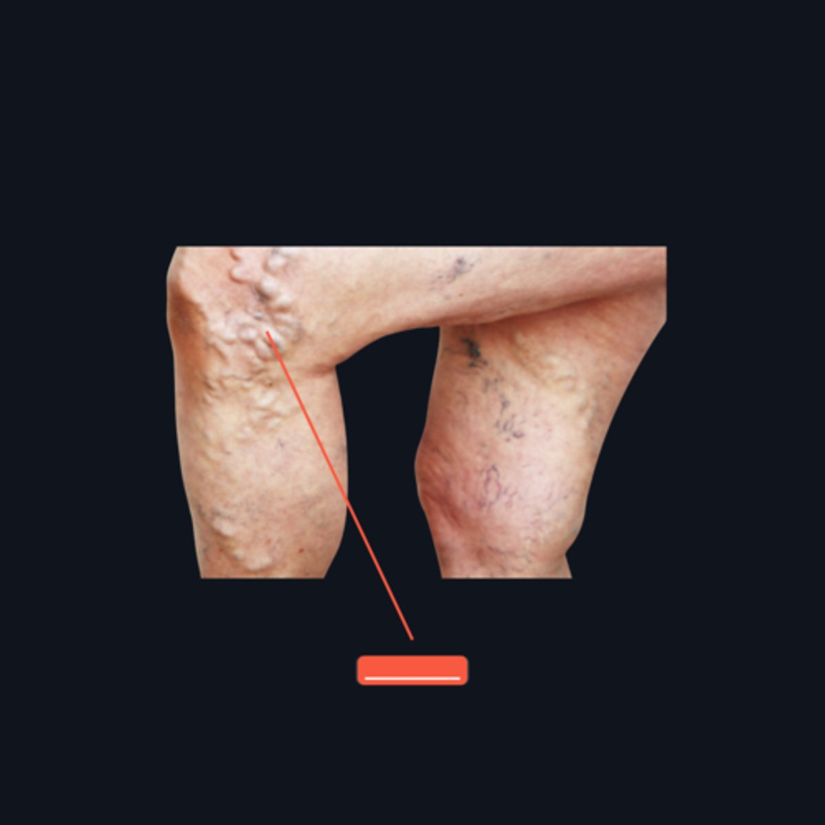 <p>Identify the medical condition and its three management strategies.</p>