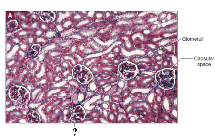 <p>lined with thin layer of simple epithelium that is ideal for reabsorption and has three main segments where filtrate passes through</p><ul><li><p>proximal convoluted tubule</p></li><li><p>nephron loop</p></li><li><p>distal convoluted tubule</p></li></ul><p></p>