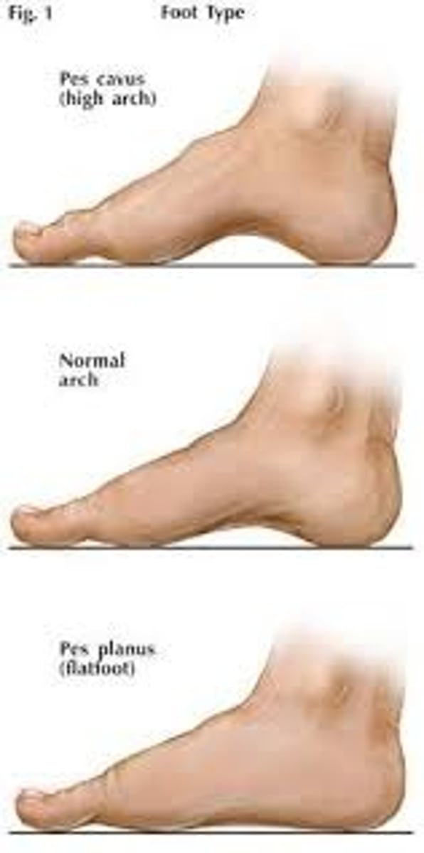 <p>foot</p>