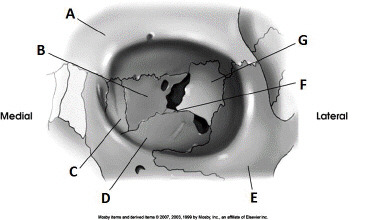 <p><strong>Identify letter A</strong><br>A. Palatine<br>B. Sphenoid<br>C. Frontal<br>D. Maxilla</p>