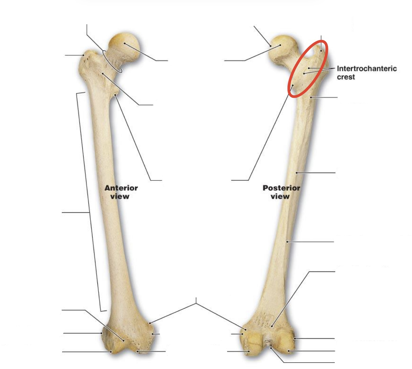 <p><span><span>Intertrochanteric crest</span></span></p>
