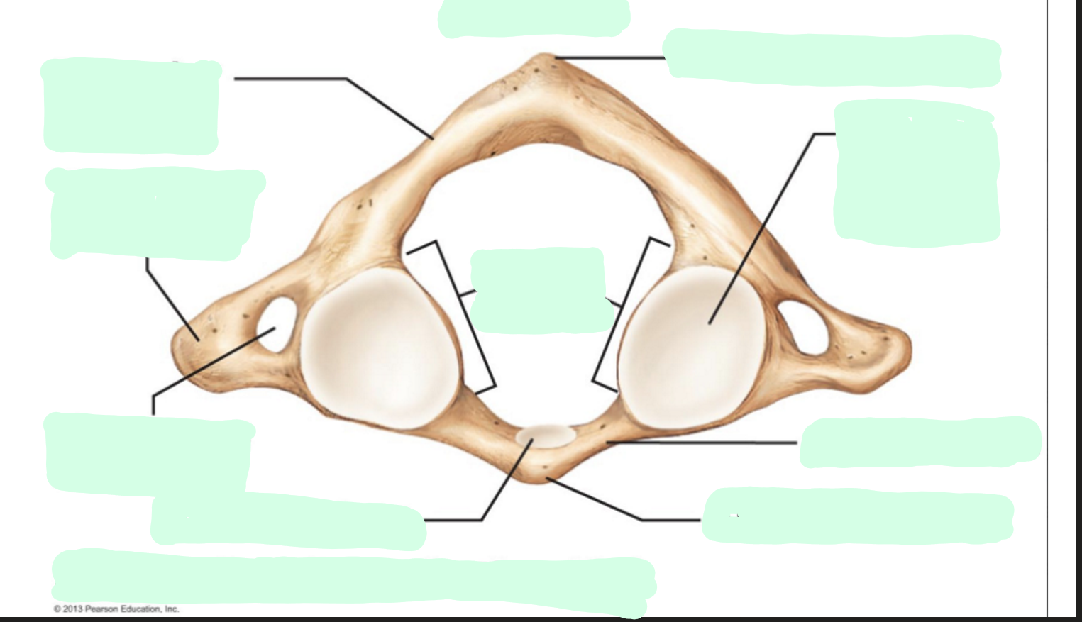 <ul><li><p>Inferior view of atlas</p></li><li><p>One of the cervical vertebrae (C1)</p></li></ul><p></p>