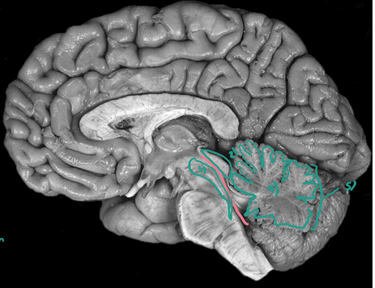 <p>What is number 4?</p>