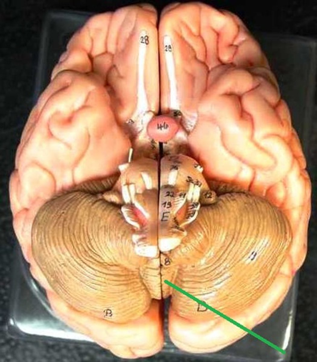 <p>(worm-like structure) connects the two hemispheres of the cerebellum</p>