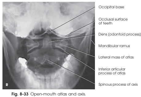 <p>Structures shown in the open-mouth AP projection</p>