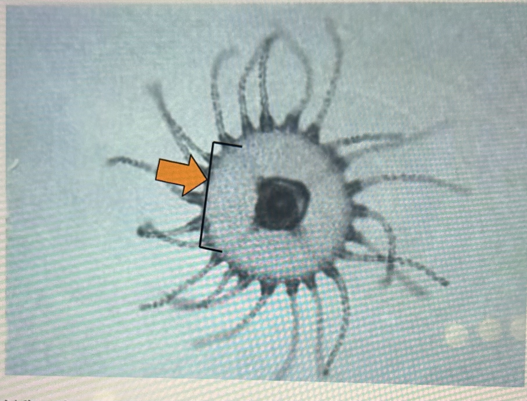 <p>What’s the arrow pointing at</p>