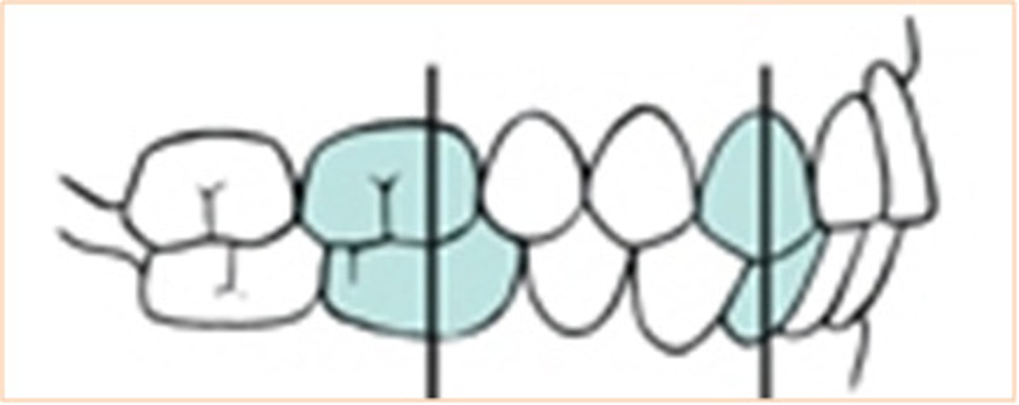 <p>Whats the occlusion</p>