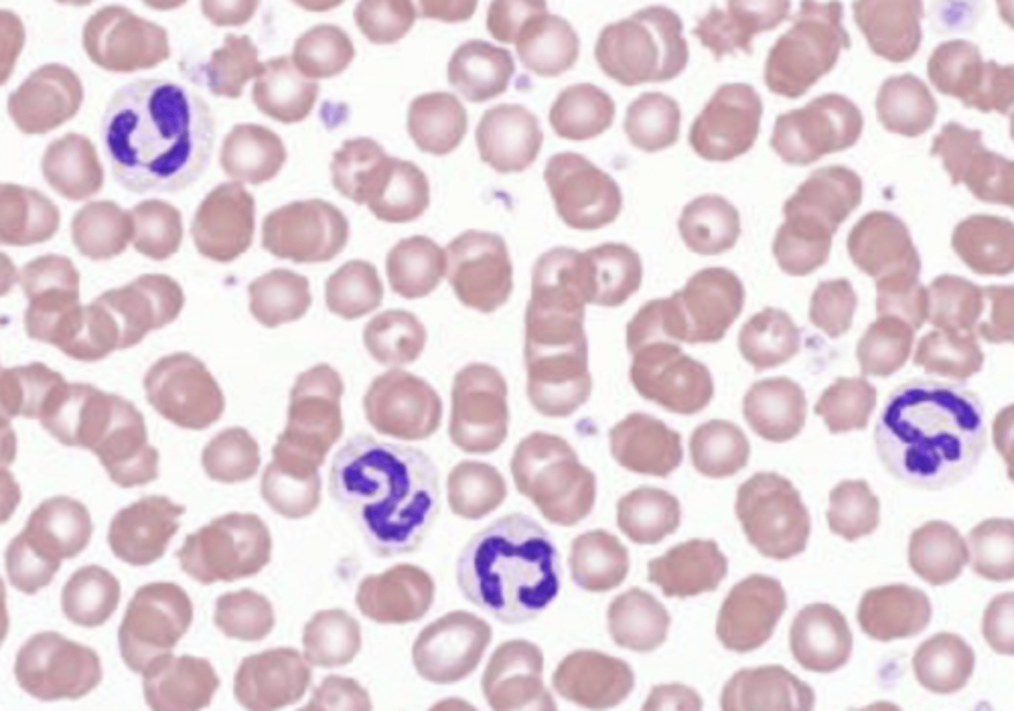 <p>is this anemia regenerative or non regenerative? why?</p>