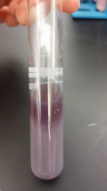 <ul><li><p><strong>*P = Translucent, R = Bleached, C = Curd</strong></p></li><li><p><strong>Color: </strong></p><ul><li><p>Translucent/Clearish Liquid<strong> OR</strong> Translucent + Soft Curd </p></li></ul></li></ul><p></p>