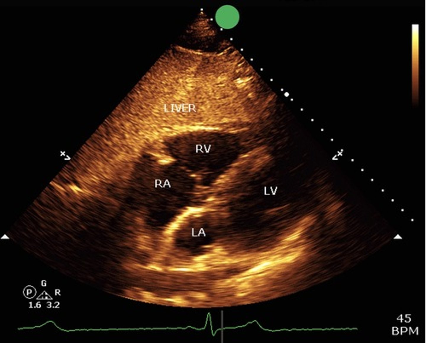 <p>what view is this?</p>