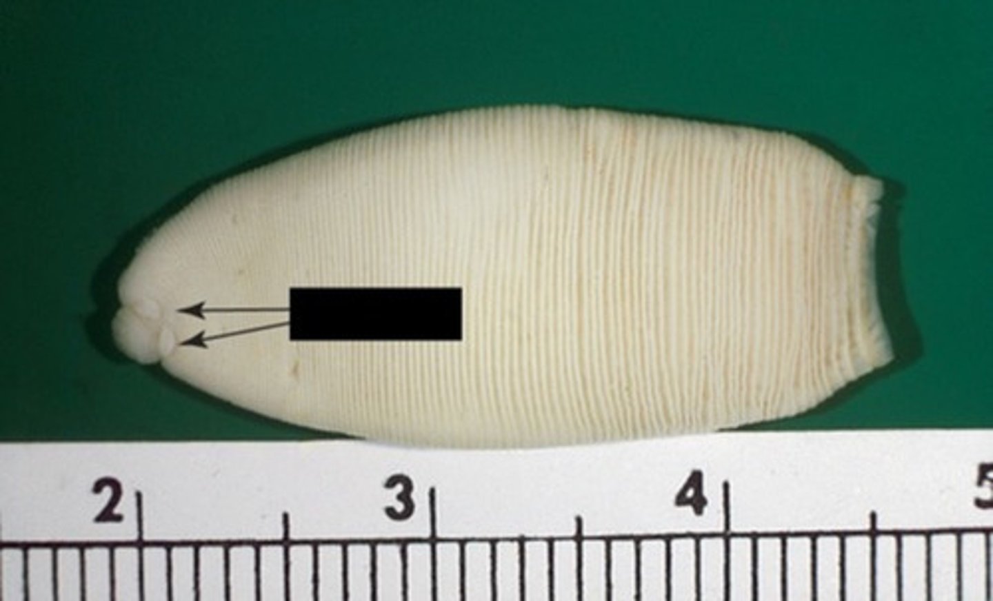 <p>What is the type of tapeworm, and what are the arrows pointing to?</p>