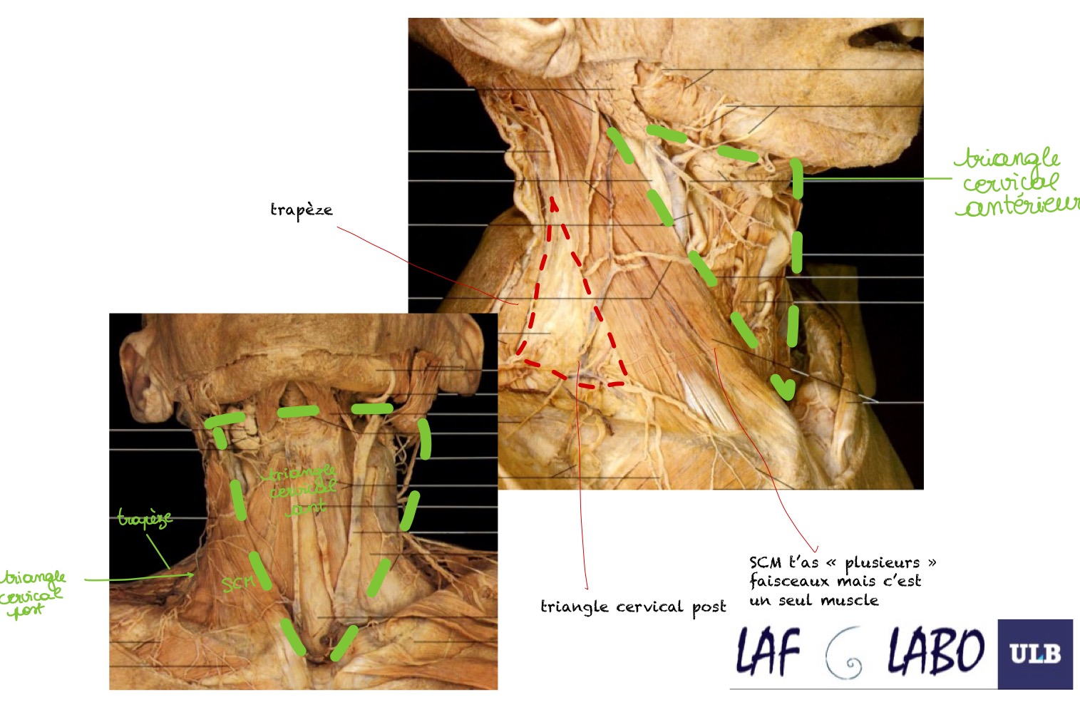 <p>le triangle cervical antérieur (qui se divise lui même en plusieurs triangles)</p>