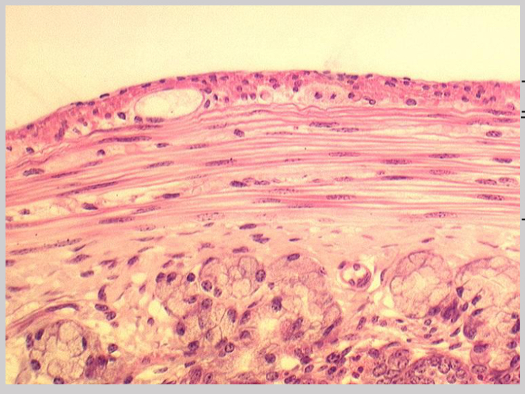 <p>What type of muscle is shown in this image?</p>