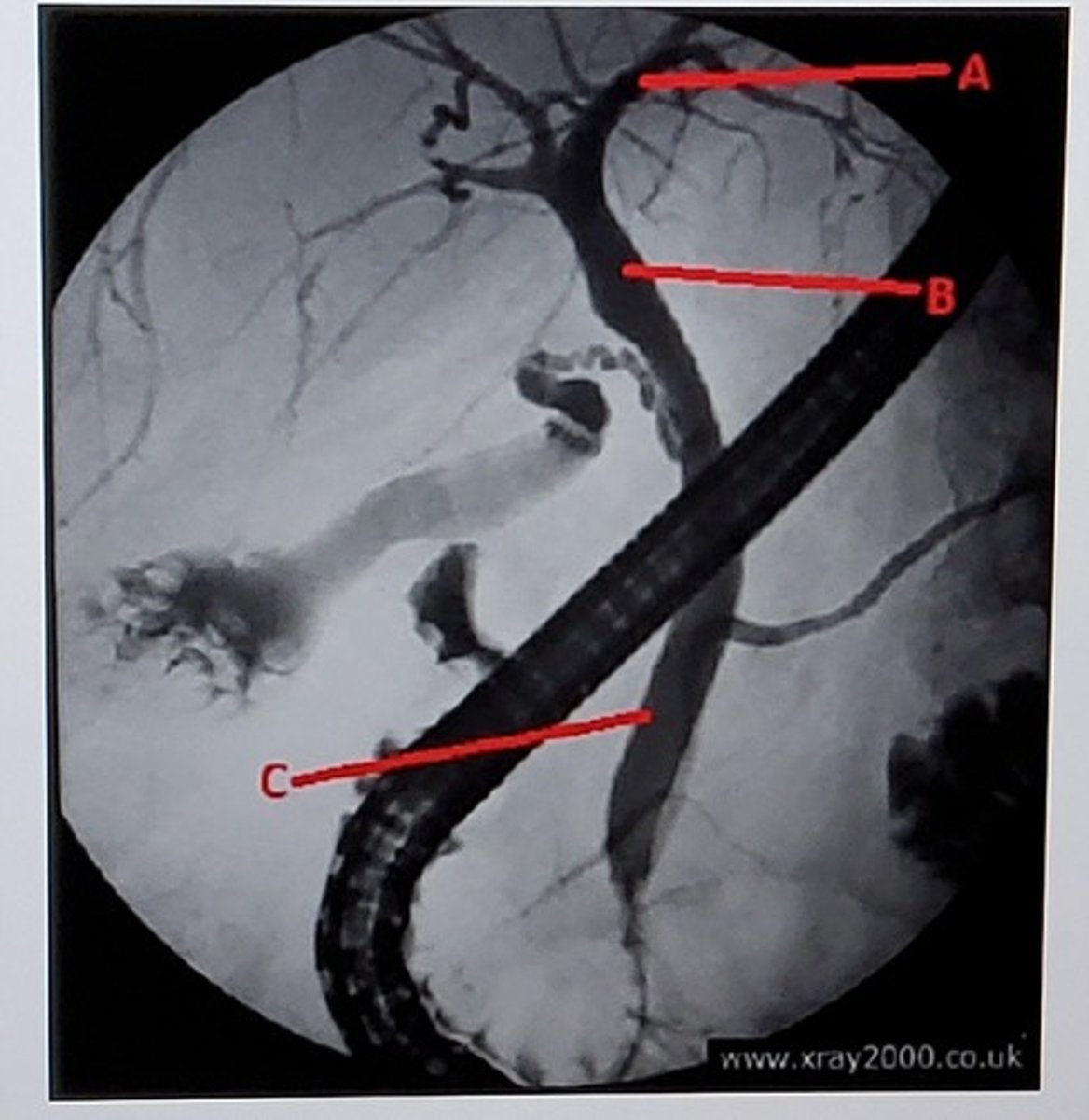 <p>Label the picture:</p>