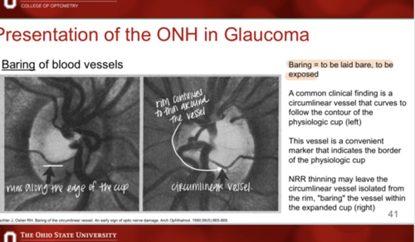 <p>What is a circumlinear vessel of the ONH?</p>
