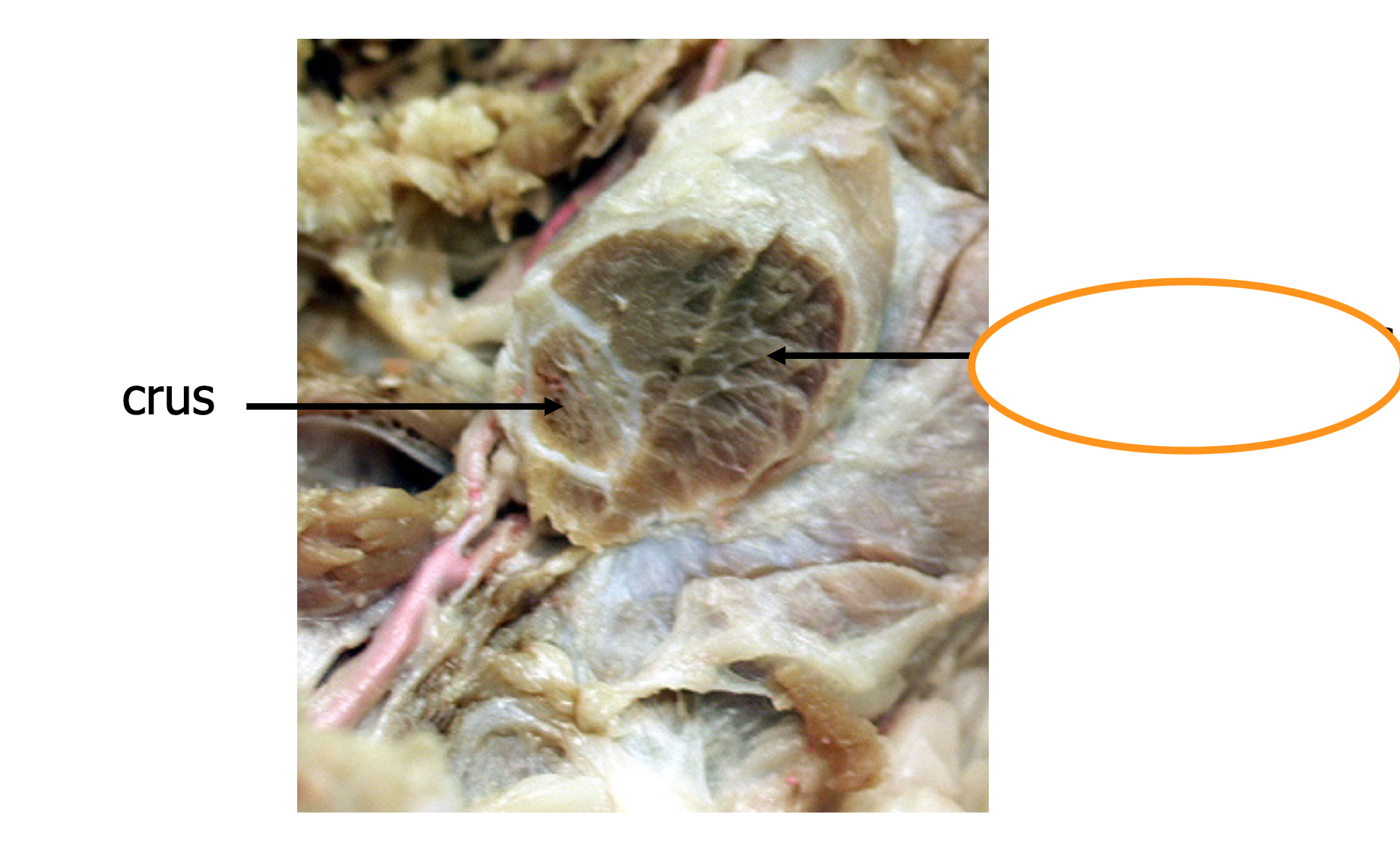 covers the crura (one "leg" of the crus), connects to the ischium
