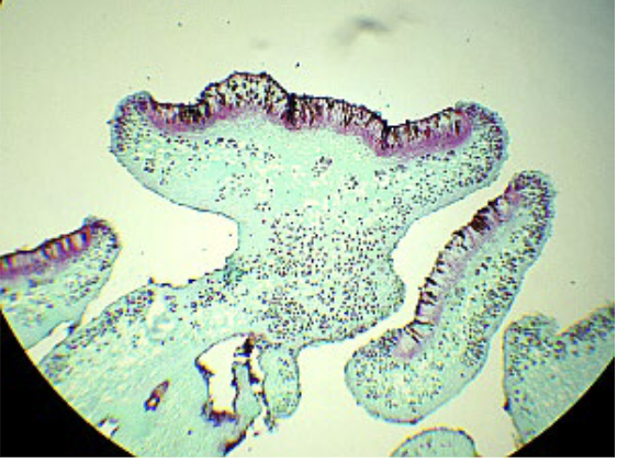 mutualistic relationship between fungi and photosynthetic (algal) organisms