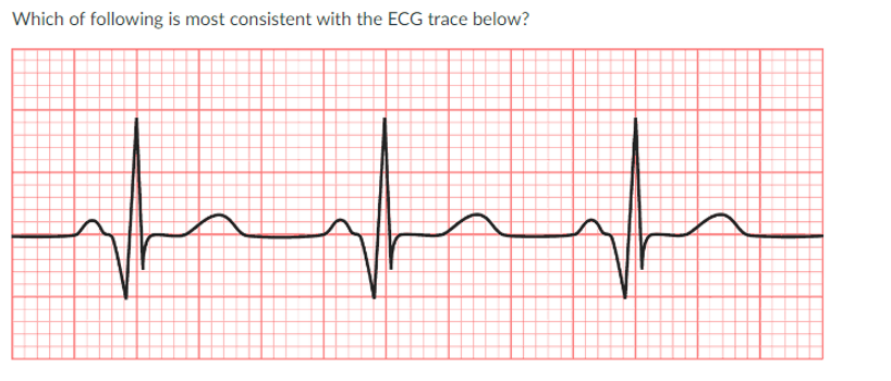 <p>JONES IN CLASS ASSIGNMENT QUESTIONS:</p><p>a. current angina event</p><p>b. severe MI several minutes ago</p><p>c. severe MI 2 days ago</p><p>d. MI several weeks ago</p>