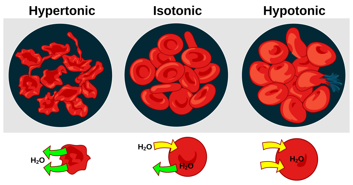 <ul><li><p><strong>In living cells, the inward of outward movement of water by osmosis develops forces that can cause cells to swell or shrink.</strong></p></li><li><p>Two solutions with equal solute concentrations are <strong>isotonic.</strong></p><p>(iso = “equal”) – Normal looking cell</p></li><li><p>If the concentration is unequal, the solution with the higher solute concentration is <strong>hypertonic.</strong> (hyper = “more than”) – shriveled cell</p></li><li><p>The solution with the lower solute concentration is <strong>hypotonic.</strong></p><p>(hypo = “less than”) – Swollen cell</p></li></ul><p></p>