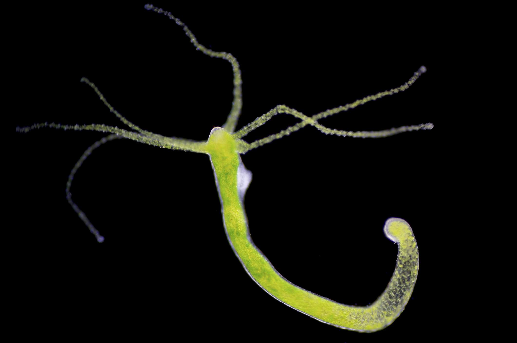 <p>This is an animal from the Cnidarian phylum. They are known for:</p><ul><li><p>radial symmetry</p></li><li><p>incomplete gut</p></li><li><p>acoelomate</p></li></ul><p></p>