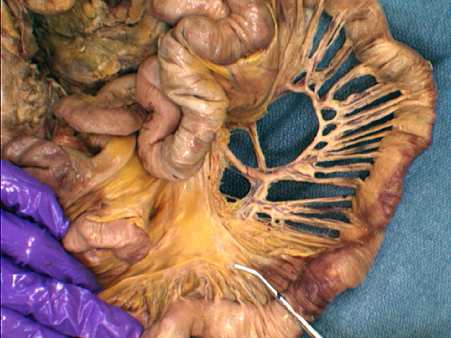 <p>Name the Mesentery</p>