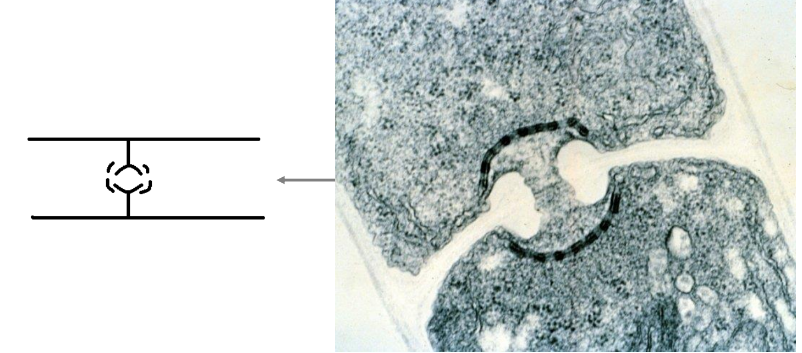 <p>Basidiomycota septal pores  (Ch. 6)</p>