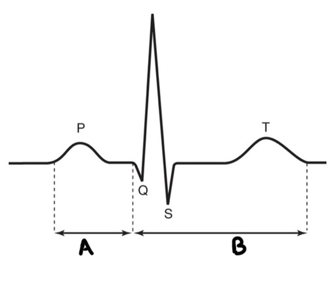 <p>how is time reflected in a Q-T interval?</p>