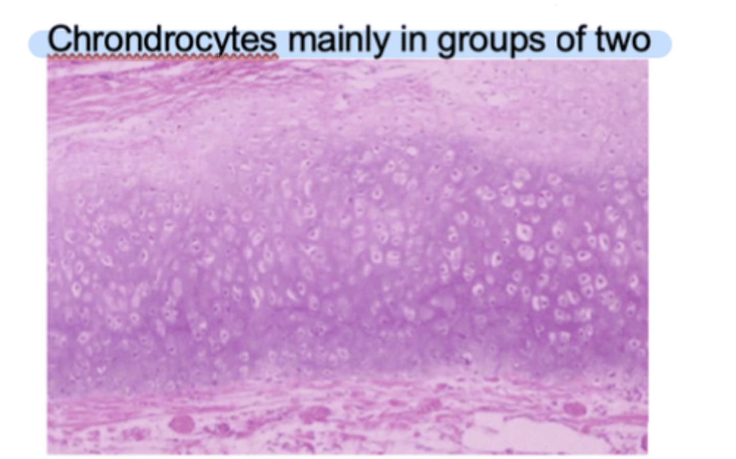<p>Fibers</p><p>- Mainly elastic but also collagen</p><p>Function</p><p>- Support and flexibility</p><p>Location</p><p>- Pinna, epiglottic, parts of larynx</p><p>- Chondrocytes mainly in groups of two</p>