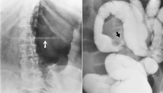 <p>Name the pathology</p>