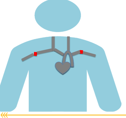 <p>What is the thoracic outlet, what pathology comes from this </p>