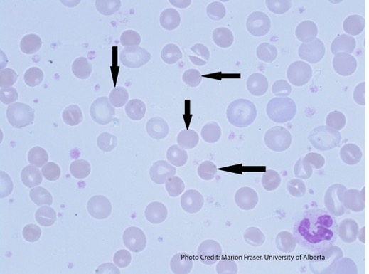 <p>No central pallor (suppose to have dark membrane and pale inside)</p>