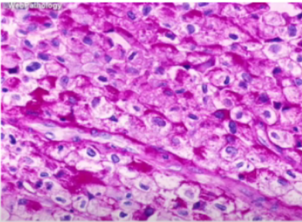 <p><span style="font-family: arial">Type of cytoplasmic inclusion that is the storage form of carbohydrates</span></p>