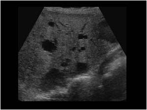 <p>What is this pathology?</p>